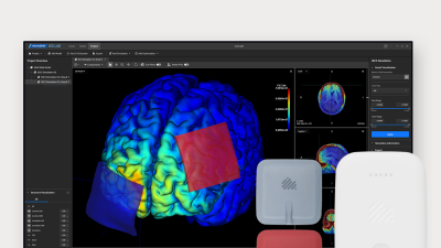 뉴로핏, 의식장애 ‘맞춤형 tDCS 솔루션’ 혁신의료기기 지정