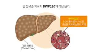 대웅제약, 중증 간 섬유증 ‘먹는 치료제’ 세계 첫 개발 나선다 
