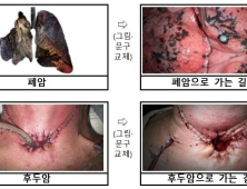 ‘폐암으로 가는 길’…담뱃갑 경고 그림·문구 강화