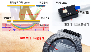 '운동 중 혈압 연속측정하는 스마트워치'… KAIST, 웨어러블 센서 개발