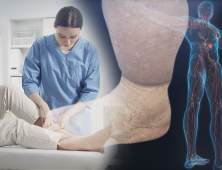 림프부종 관리, 수치로 말하다…체성분 측정기기의 힘 [이노메디㉜]